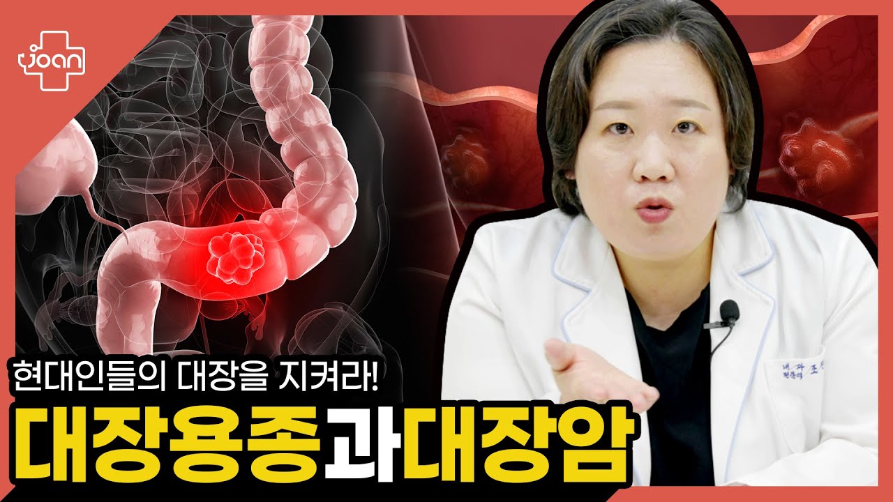 대장용종과 대장암 썸네일 이미지